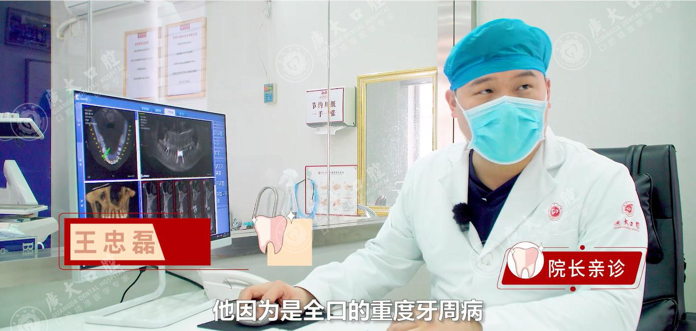 广州种牙技术—广大口腔GA精准植桥即刻负重，一天恢复半口好牙